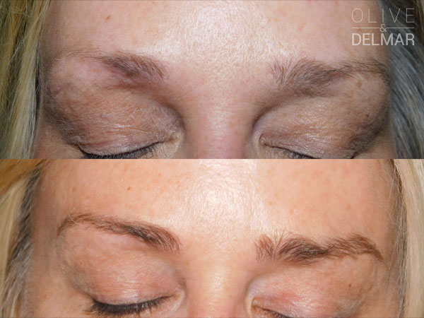 Neubrow deals